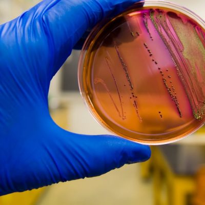 Escherichia coli why uci bio sci grad