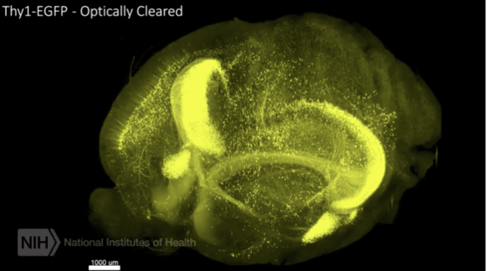 Video of Neurons in motion