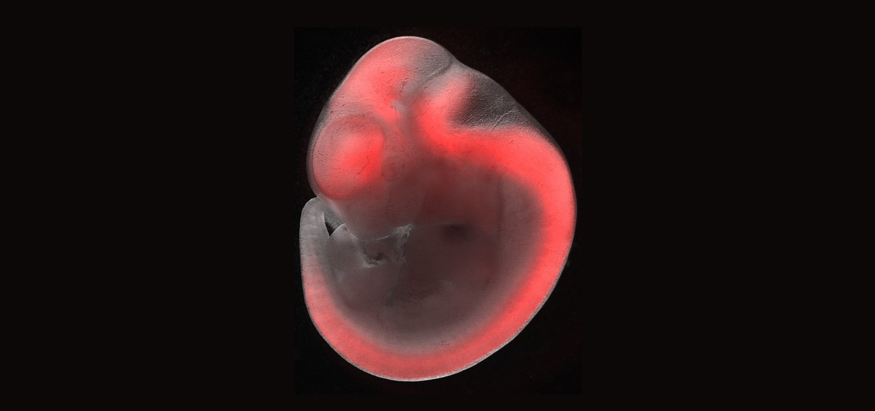 Image of a developing mouse embryo.