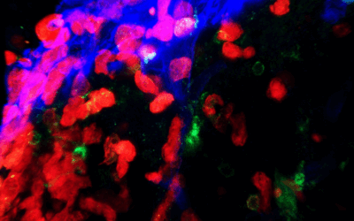UC Irvine Study Identifies Overlooked Immune Cell Pathway Into the Brain