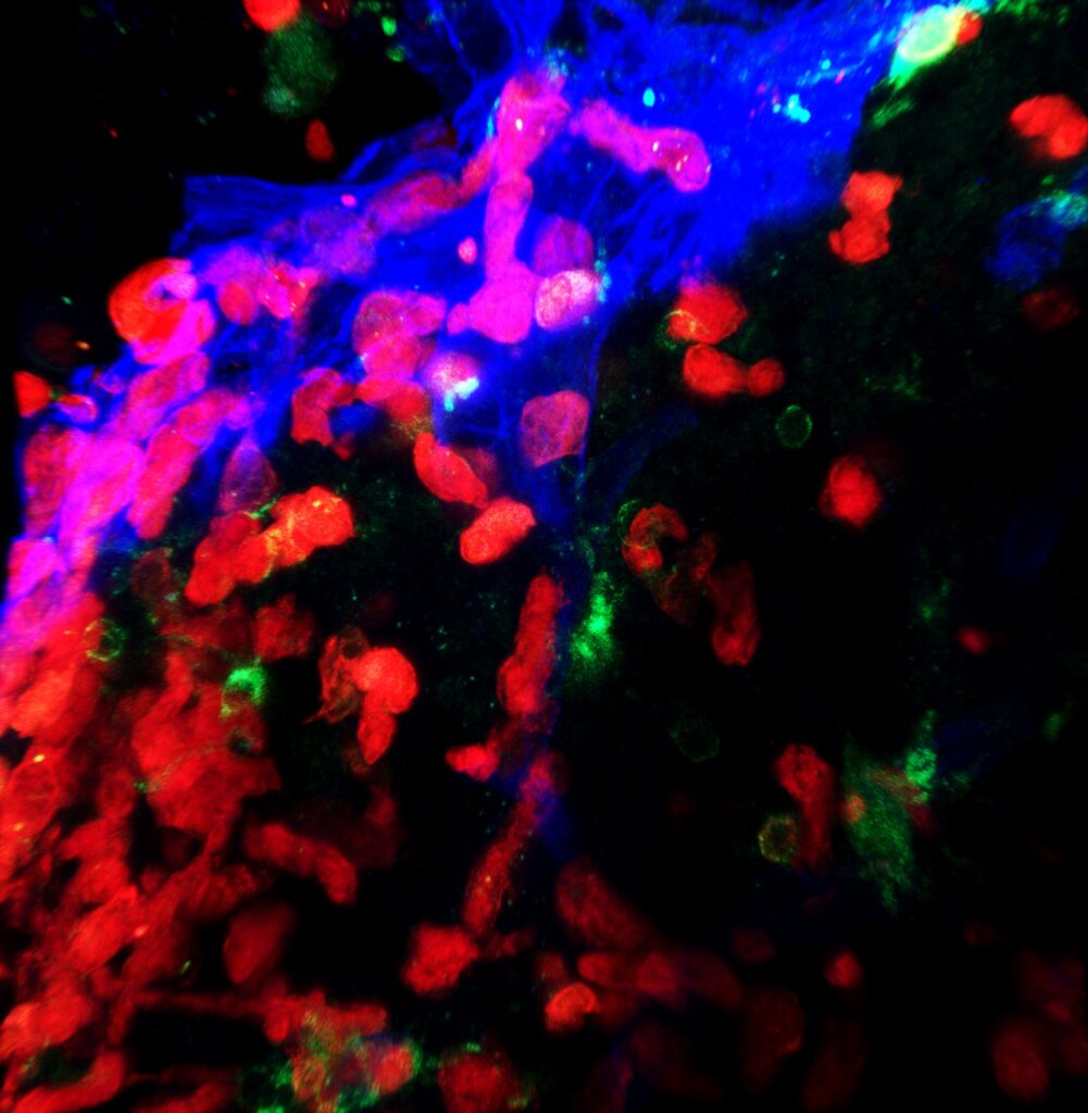 CCR2+ (red, monocytes) cells enter the brain parenchyma from the velum interpositum (blue, laminin). CX3CR1+ cells (green) represent resident macrophages or microglia. Photo credit: Rocio Barahona, Lindsay Hohsfield, and Kim Green.
