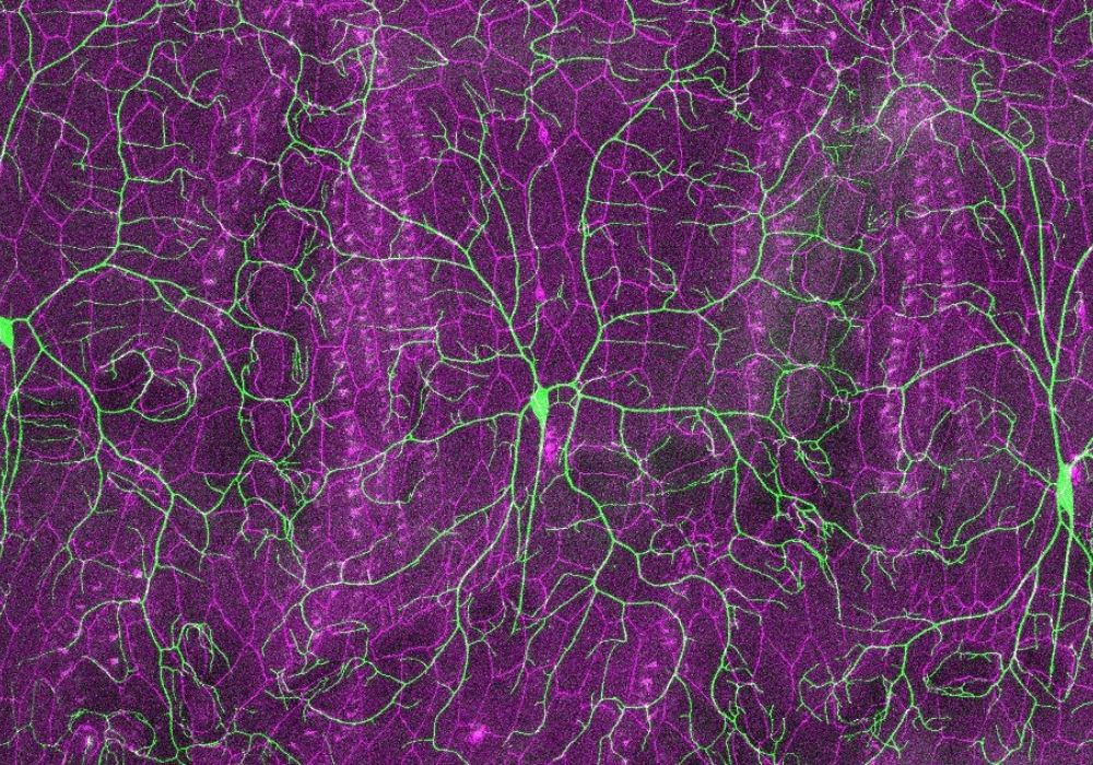 neurons